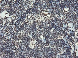 NONO / P54NRB Antibody (clone OTI2C9)