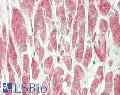 IHC-plus™ MARCH1 Antibody (Internal)
