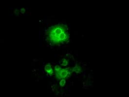 Monoclonal Mouse anti-Human CYPOR / POR Antibody (clone OTI3F10, IHC, IF, WB)
