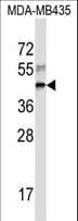 RPL3 / Ribosomal Protein L3 Antibody (aa224-251)