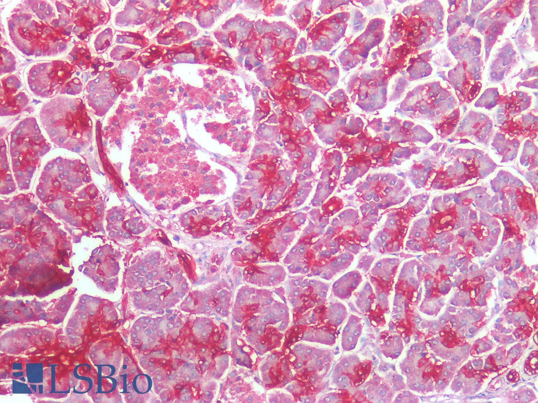 IHC-plus™ AQP1 / Aquaporin 1 Antibody (clone OTI2D10)