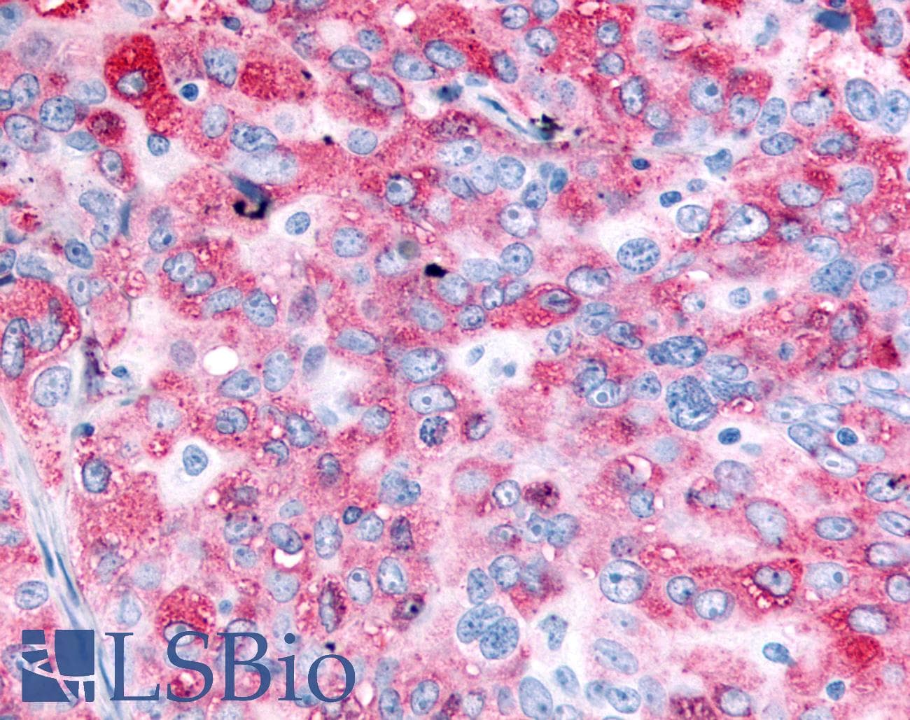 PathPlus™ Polyclonal Rabbit anti-Human EGFR Antibody (C-Terminus, IHC)