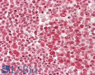 IHC-plus™ Polyclonal Rabbit anti-Human FACT / SSRP1 Antibody (aa150-200, IHC, WB)