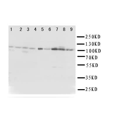 TRPC3 Antibody (aa836-851)