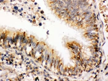 Polyclonal Rabbit anti-Human PDIA3 / ERp57 Antibody (IHC, WB)
