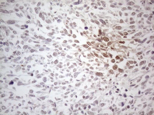 MLANA / Melan-A Antibody (aa48-118, clone OTI4F12)