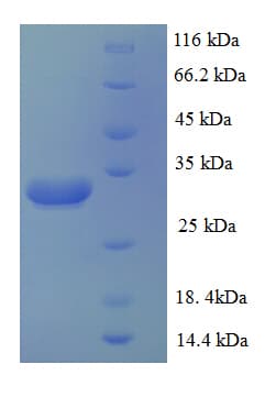 Human SLC39A1 Protein (Recombinant His)
