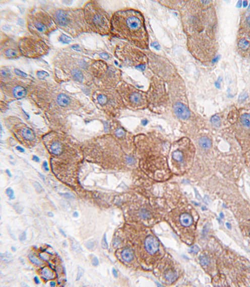 Polyclonal Rabbit anti-Human CYP3A5 Antibody (aa476-502, IHC, IF, WB)