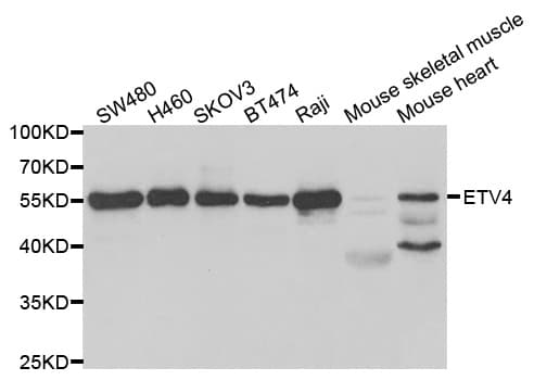 PEA3 / ETV4 Antibody
