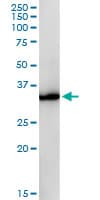GPD1 Antibody (clone 3C10-1C4)
