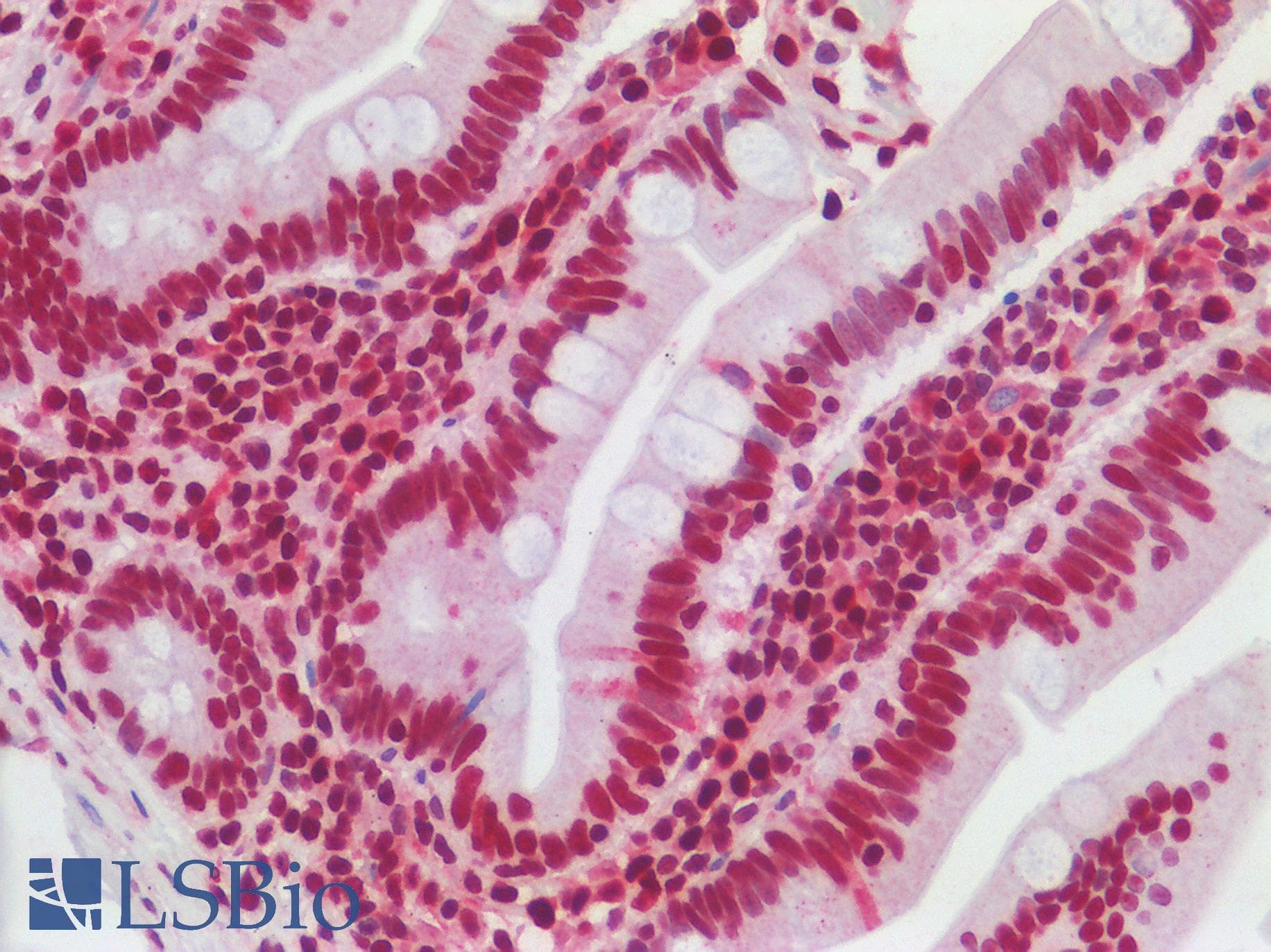 IHC-plus™ SUB1 Antibody (aa77-127)