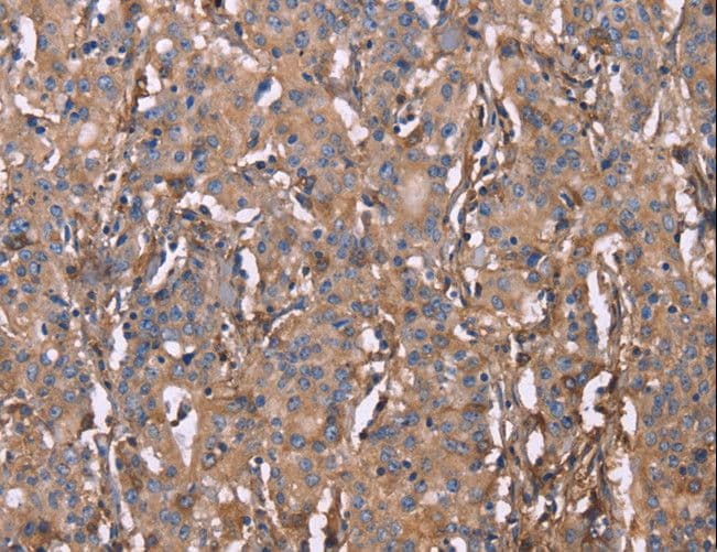HP / Haptoglobin Antibody