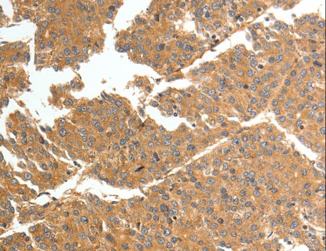 TNN / Tenascin N Antibody