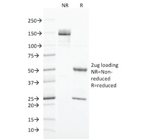 KRT20 / CK20 / Cytokeratin 20 Antibody (clone KRT20/1993, Ready-to-Use)