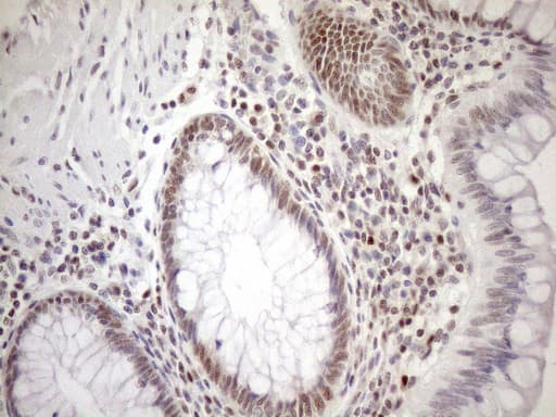MGMT Antibody (clone OTI5A7, Carrier-free)