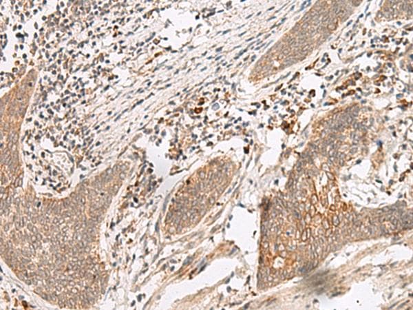 FUT10 Antibody