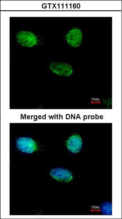 Polyclonal Rabbit anti-Human MCM3 Antibody (aa42-302, IHC, WB)