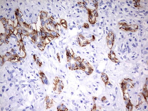 Monoclonal Mouse anti-Human EPCAM Antibody (clone UMAB131, IHC, WB)