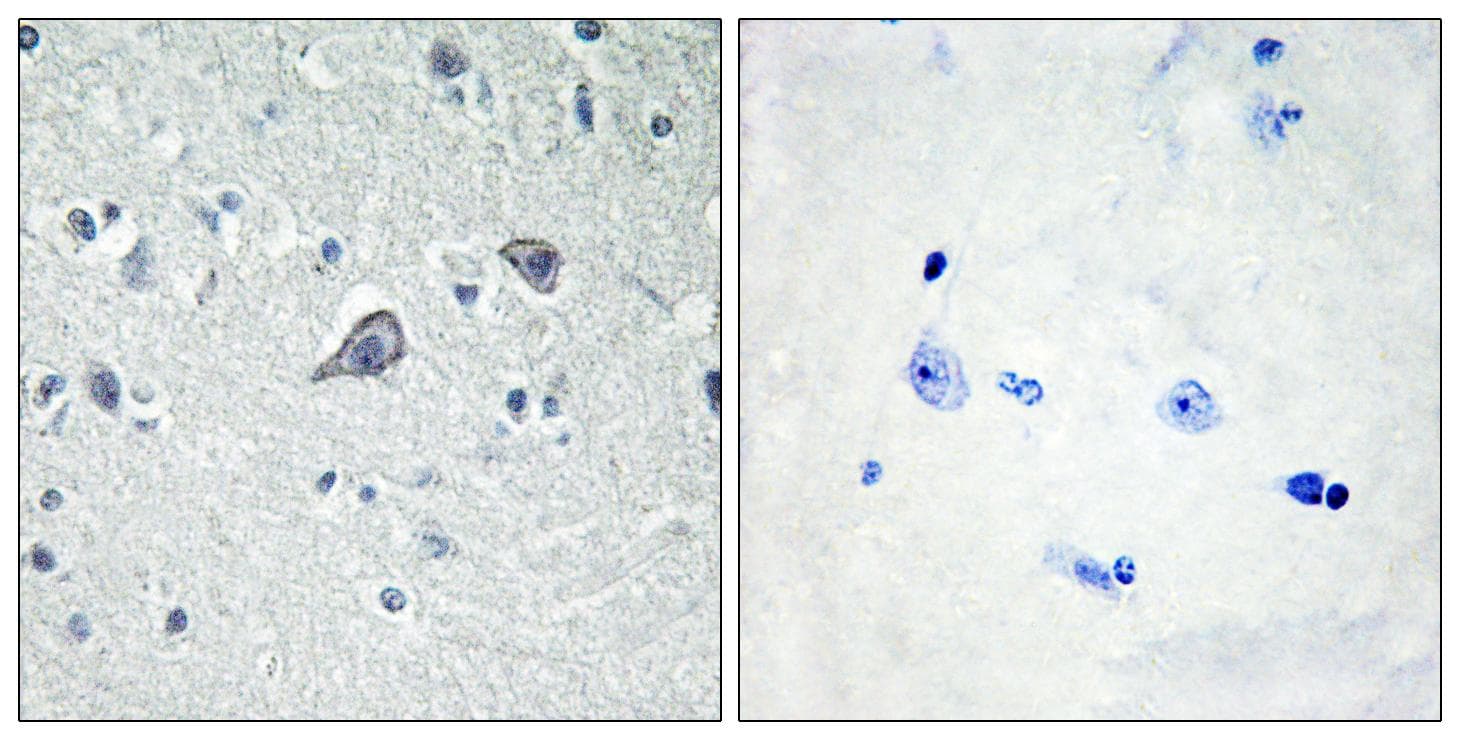 Polyclonal Rabbit anti-Human ADORA2A/Adenosine A2A Receptor Antibody (IHC, IF, WB)