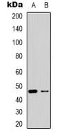 OXER1 Antibody (Internal)