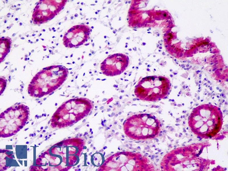 IHC-plus™ Monoclonal Mouse anti-Human GIPC1 / GIPC Antibody (clone AT1G10, IHC, WB)