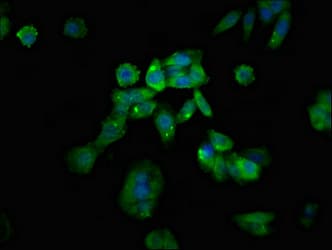Polyclonal Rabbit anti-Human RGS1 Antibody (IHC, IF)