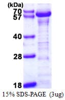 Human KLF4 Protein (Recombinant His)