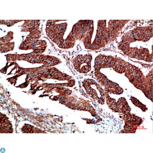 PTEN Antibody