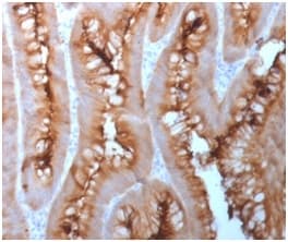 Recombinant Monoclonal Rabbit anti-Human CEACAM1,5 Antibody (clone C66/1983R, Azide-free,Carrier-free, IHC)