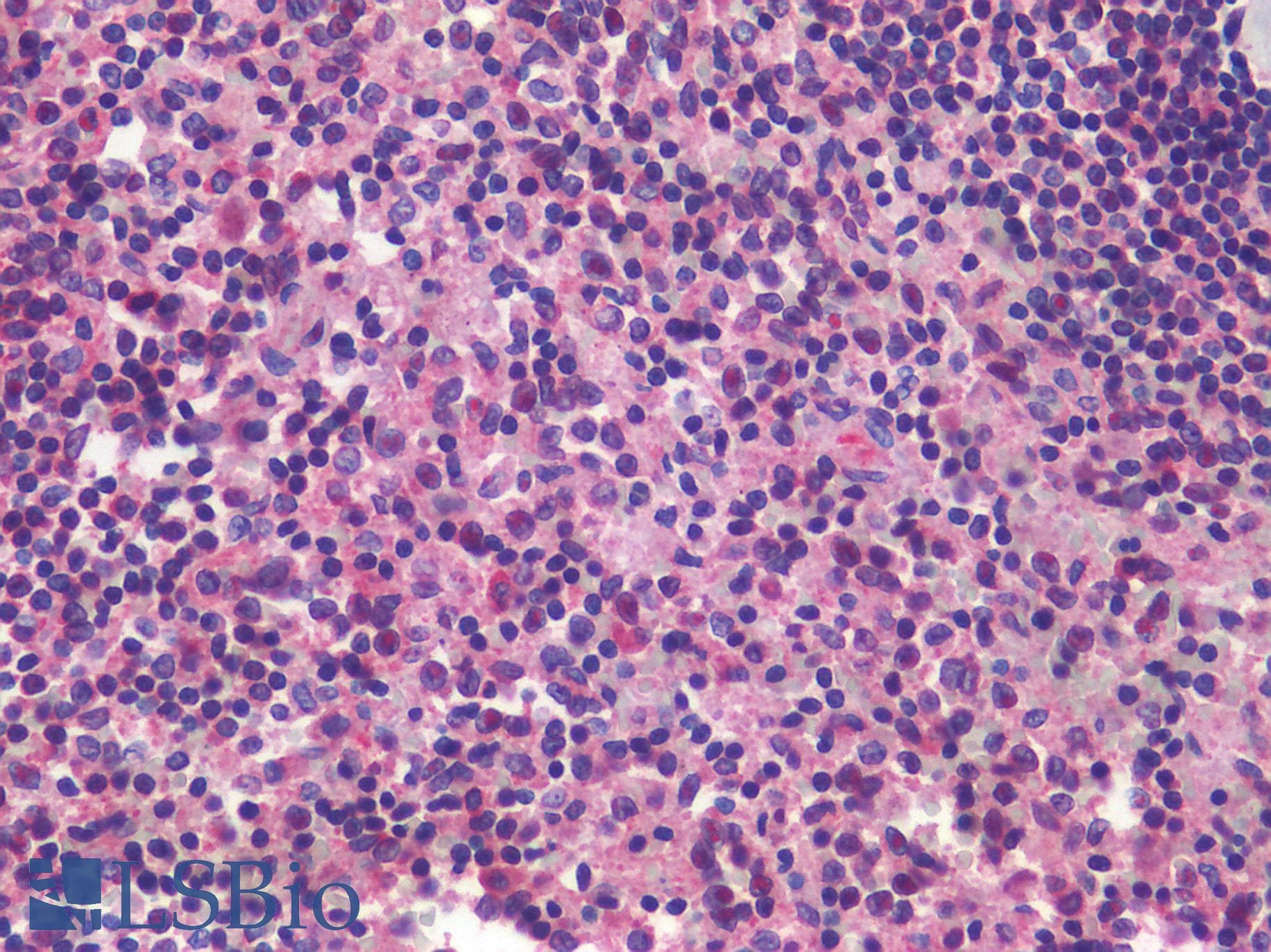 PathPlus™ ITGAX / CD11c Antibody (Internal)