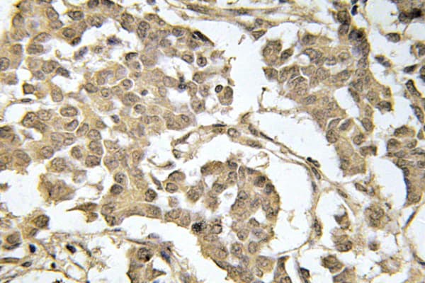 EIF2S1 Antibody (phospho-Ser51)