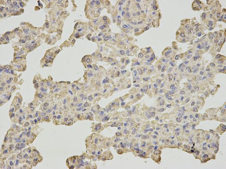 IHC-plus™ SLC4A4 / NBC1 Antibody