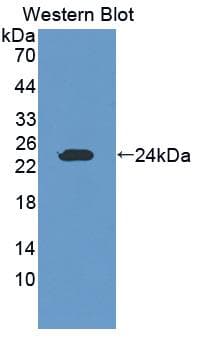 GZMK / Granzyme K Antibody (aa44-227)