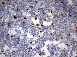 Monoclonal Mouse anti-Human MKI67 / Ki67 Antibody (clone OTI1F11, Carrier-free, aa1160-1493, IHC, WB)