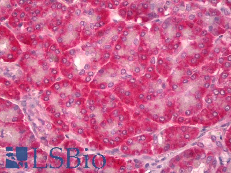 IHC-plus™ Monoclonal Mouse anti-Human CCN3 / NOV Antibody (clone 2G8, IHC, WB)