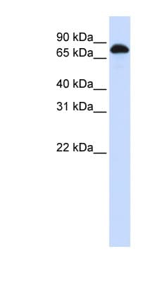 STAT3 Antibody (N-Terminus)