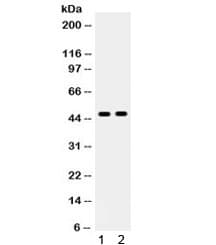 Polyclonal Rabbit anti-Human AGTR1 / AT1 Receptor Antibody (IHC, WB)