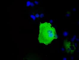 Heat Shock Protein 70 / HSPA1A Antibody (clone OTI3G9)