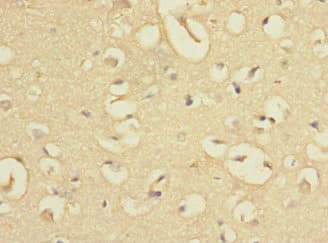 EVI2A Antibody
