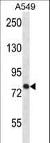 TRPC3 Antibody (aa765-793)