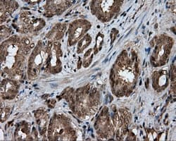 GBE1 Antibody (clone OTI3B4)