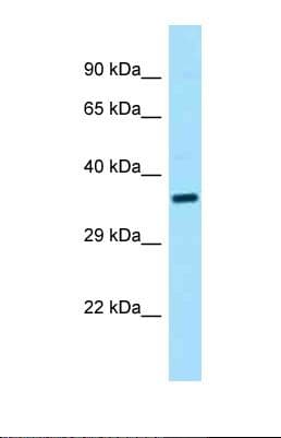 CENPU / MLF1IP Antibody (aa214-263)