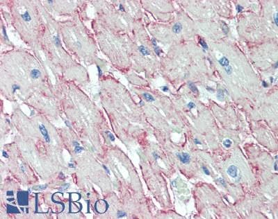 IHC-plus™ ADGRL4 / ELTD1 Antibody (230-310 aa, Internal)