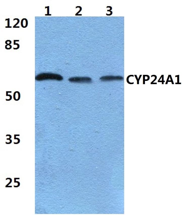 IHC-plus™ Polyclonal Rabbit anti-Human CYP24 / CYP24A1 Antibody (aa400-450, IHC, WB)