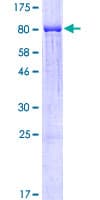 Human PFK2 / PFKFB3 Protein (Recombinant GST)