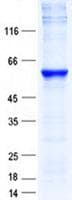 Human NR1A2 / THRB Protein (Recombinant His, N-Terminal)