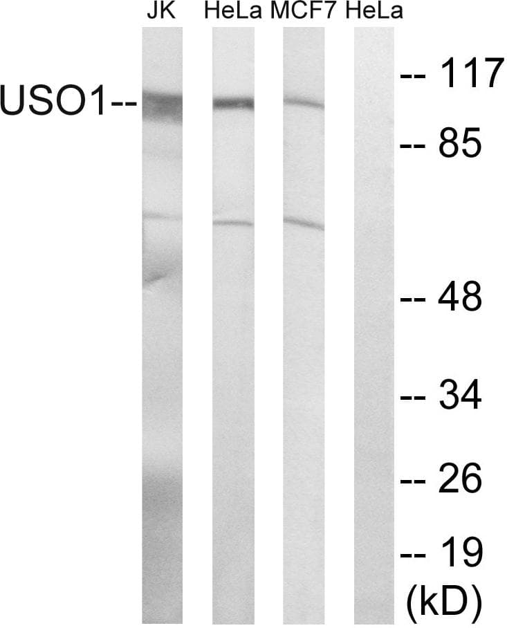 US01 / p115 Antibody