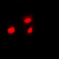 HSF1 Antibody (C-Terminus)