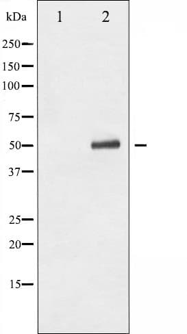 TP53 / p53 Antibody (phospho-Ser9)