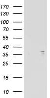 ART1 /CD296 Antibody (aa83-295, clone OTI6E2, Carrier-free)